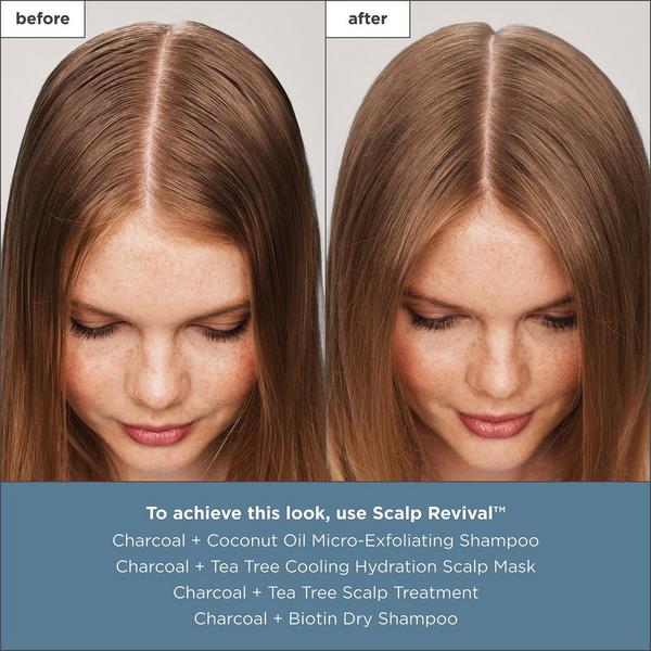 Briogeo Scalp Revival Charcoal + Tea Tree Scalp Treatment Serum #5